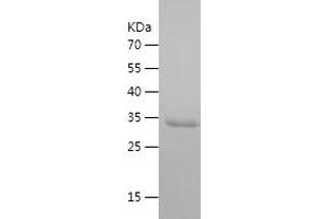 Western Blotting (WB) image for Preferentially Expressed Antigen in Melanoma (PRAME) (AA 321-420) protein (His-IF2DI Tag) (ABIN7124547)