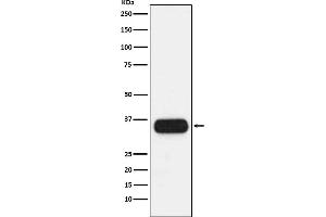 Western blot analysis of HLA-DQA1 expression in human spleen lysate.