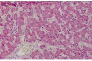 Human Liver: Formalin-Fixed, Paraffin-Embedded (FFPE) (GSTM1 anticorps  (AA 1-159))
