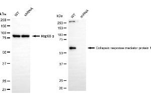 Western blotting analysis using collapsin response mediator protein 1 antibody (ABIN7798129). (Recombinant CRMP1 anticorps)