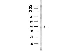 anti-Retinol Dehydrogenase 12 (All-Trans/9-Cis/11-Cis) (RDH12) antibody