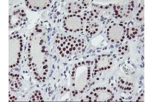 Image no. 2 for anti-Ankyrin Repeat Domain 53 (ANKRD53) (AA 1-300) antibody (ABIN1490719) (ANKRD53 anticorps  (AA 1-300))