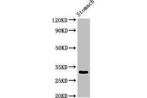 Western Blot Positive WB detected in: Rat stomach tissue All lanes: GCLM antibody at 3 μg/mL Secondary Goat polyclonal to rabbit IgG at 1/50000 dilution Predicted band size: 31, 29 kDa Observed band size: 31 kDa (GCLM anticorps  (Regulatory Subunit))
