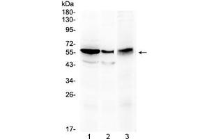 Western blot testing of 1) rat kidney, 2) mouse stomach and 3) human HepG2 lysate with ALDH1A3 antibody at 0. (ALDH1A3 anticorps)