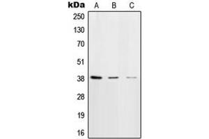 Western blot analysis of DNA Polymerase beta expression in HeLa (A), NIH3T3 (B), rat brain (C) whole cell lysates.