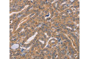 Immunohistochemistry (IHC) image for anti-Cell Division Cycle Associated 4 (CDCA4) antibody (ABIN2432829)