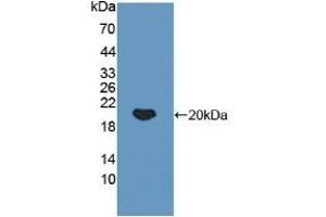 Detection of Recombinant IkBa, Human using Polyclonal Antibody to Inhibitory Subunit Of NF Kappa B Alpha (IkBa)
