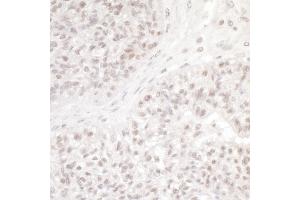anti-NSL1, MIND Kinetochore Complex Component, Homolog (NSL1) (AA 150-200) antibody