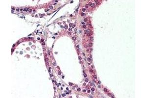Immunohistochemistry (IHC) image for anti-Nuclear Receptor Subfamily 1, Group D, Member 2 (NR1D2) (C-Term) antibody (ABIN2470775)
