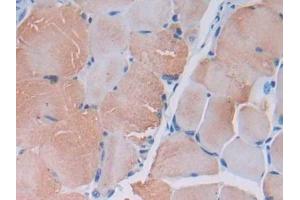 DAB staining on IHC-P; Samples: Mouse Skeletal muscle Tissue (MYLK2 anticorps  (AA 330-548))