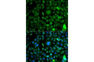 Immunofluorescence analysis of A549 cell using DPF1 antibody. (DPF1 anticorps)