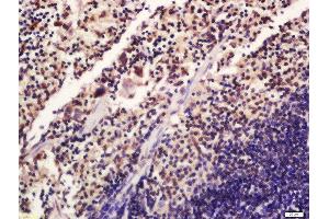 Formalin-fixed and paraffin embedded mouse spleen labeled with Rabbit Anti-SATB1 (Ser47) Polyclonal Antibody, Unconjugated 1:200 followed by conjugation to the secondary antibody and DAB staining (SATB1 anticorps  (pSer47))