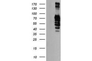Western Blotting (WB) image for anti-Golgi Membrane Protein 1 (GOLM1) antibody (ABIN1498492) (GOLM1 anticorps)