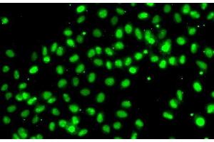 Immunofluorescence analysis of A549 cells using MEPCE Polyclonal Antibody (MEPCE anticorps)