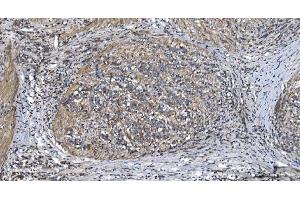 IHC analysis of STIL/SIL using anti-STIL/SIL antibody (ABIN7599923). (STIL anticorps  (AA 13-1287))