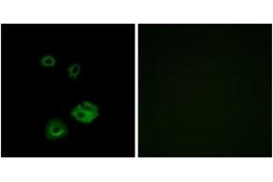 Immunofluorescence analysis of A549 cells, using NPY2R Antibody.