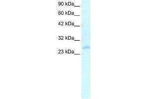 WB Suggested Anti-HOXC4 Antibody Titration:  2. (HOXC4 anticorps  (N-Term))