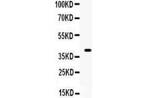 Western Blotting (WB) image for anti-Wingless-Type MMTV Integration Site Family, Member 1 (WNT1) (AA 45-74), (N-Term) antibody (ABIN3042350) (WNT1 anticorps  (N-Term))