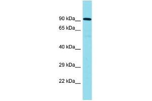 Host: Rabbit Target Name: CNOT10 Sample Type: Placenta lysates Antibody Dilution: 1. (CNOT10 anticorps  (C-Term))