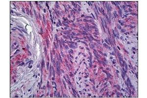 Human Uterus, Myometrium: Formalin-Fixed, Paraffin-Embedded (FFPE) (IFITM1 anticorps)