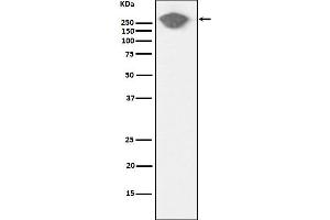 Western blot analysis of Fibronectin expression in Human serum cell lysate.