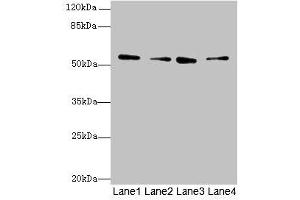 Western blot All lanes: ERO1B antibody at 3. (ERO1LB anticorps  (AA 101-400))