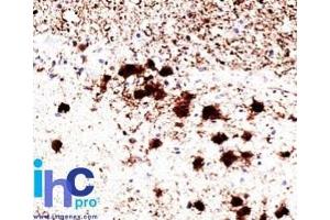 Formalin-fixed, paraffin-embedded human brain stained with Pgp9. (UCHL1 anticorps)