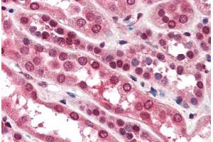 Human Kidney (formalin-fixed, paraffin-embedded) stained with ZNF292 antibody ABIN364490 at 10 ug/ml followed by biotinylated goat anti-rabbit IgG secondary antibody ABIN481713, alkaline phosphatase-streptavidin and chromogen. (ZNF292 anticorps)