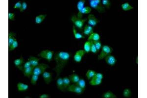 Immunofluorescence staining of MCF-7 cells with ABIN7142656 at 1:66, counter-stained with DAPI. (DCLRE1B anticorps  (AA 345-493))