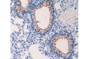 IHC-P analysis of lung tissue, with DAB staining. (CCL4 anticorps  (AA 24-92))