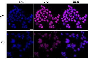 Immunocytochemical staining of HeLa cells using CTCF antibody (ABIN7797950), 1:1,000), Top panel: wild-type (WT), Bottom panal: CTCF shRNA knockdown (KD).