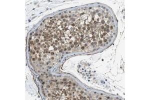 Immunohistochemical staining of human testis with ENTPD7 polyclonal antibody  shows moderate nuclear and cytoplasmic positivity in cells in seminiferus ducts at 1:20-1:50 dilution. (ENTPD7 anticorps)
