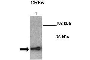 Sample Type: Lane 1:241 µg mouse left ventricle heart lysate Primary Antibody Dilution: 1:0000Secondary Antibody: Anti-rabbit-HRP Secondary Antibody Dilution: 1:0000 Color/Signal Descriptions: GRK5  Gene Name: Kathleen Gabrielson Submitted by: (GRK5 anticorps  (Middle Region))