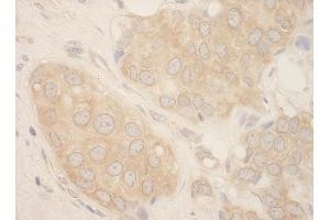 Immunohistochemistry (IHC) image for anti-SFRS Protein Kinase 2 (SRPK2) (AA 425-475) antibody (ABIN7449028) (SRPK2 anticorps  (AA 425-475))