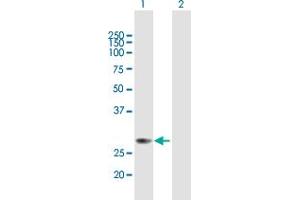Western Blot analysis of METTL6 expression in transfected 293T cell line by METTL6 MaxPab polyclonal antibody. (METTL6 anticorps  (AA 1-255))
