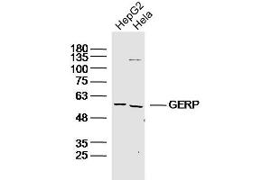 Lane 1: HepG2 lysates Lane 2: Hela lysates probed with GERP Polyclonal Antibody, Unconjugated  at 1:300 dilution and 4˚C overnight incubation. (TRIM8 anticorps)