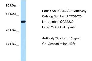 Western Blotting (WB) image for anti-Golgi Reassembly Stacking Protein 2, 55kDa (GORASP2) (C-Term) antibody (ABIN2789010) (GORASP2 anticorps  (C-Term))