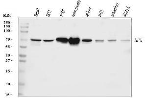 Western blot analysis of Hemopexin/HPX using anti-Hemopexin/HPX antibody (ABIN7602708).