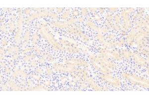 DAB staining on IHC-P;Samples: Mouse Kidney Tissue;Primary Ab: 20μg/ml Rabbit Anti-Mouse PDGFBB Antibody. (PDGF-BB Homodimer (AA 21-241) anticorps)