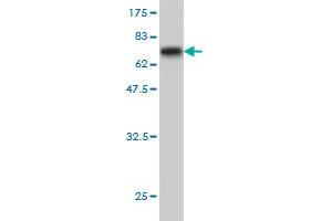 Western Blot detection against Immunogen (64. (ABHD5 anticorps  (AA 1-349))