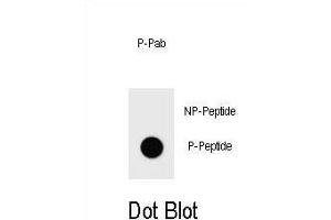 Dot blot analysis of Phospho-IKKB- Antibody Phospho-specific Pab h on nitrocellulose membrane.