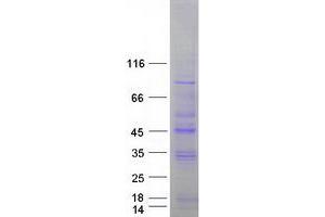Validation with Western Blot