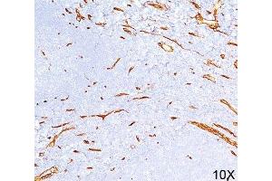IHC testing of human tonsil (10X) stained with CD34 antibody (QBEnd/10).