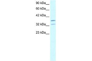 WB Suggested Anti-FOXL1 Antibody Titration:  2. (FOXL1 anticorps  (N-Term))