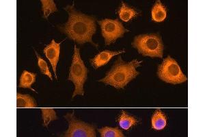 Immunofluorescence analysis of L929 cells using RIG-I / DDX58 Polyclonal Antibody at dilution of 1:100. (DDX58 anticorps)