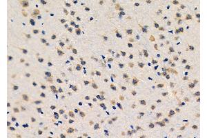 ABIN6261721 and ABIN6276601 at 1/100 staining Mouse brain tissue by IHC-P. (FGF10 anticorps  (C-Term))