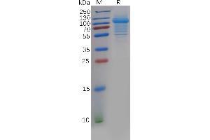 Human IL5RA Protein, hFc Tag on SDS-PAGE under reducing condition.