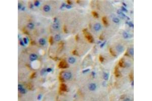 IHC-P analysis of Liver tissue, with DAB staining. (CD79b anticorps  (AA 26-225))