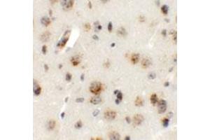 Immunohistochemical staining of mouse brain cells with AP3B2 polyclonal antibody  at 5 ug/mL. (AP3B2 anticorps  (N-Term))