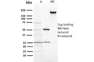 SDS-PAGE Analysis Purified ACTH Monoclonal Antibody (57).